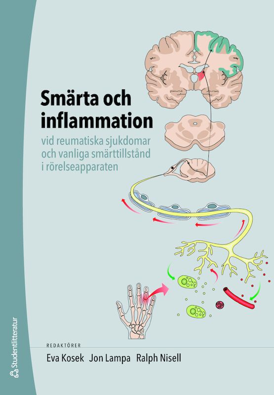Omslag: Smärta och inflammation - vid reumatiska sjukdomar och vanliga smärttillstånd i rörelseapparaten