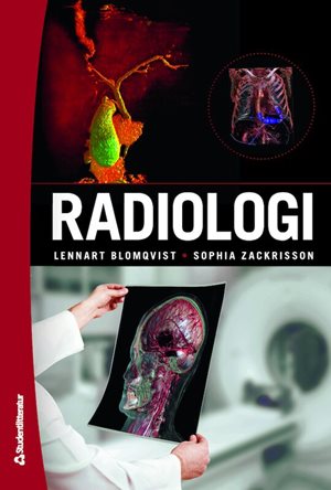 ISBN 9789144129013 Radiologi