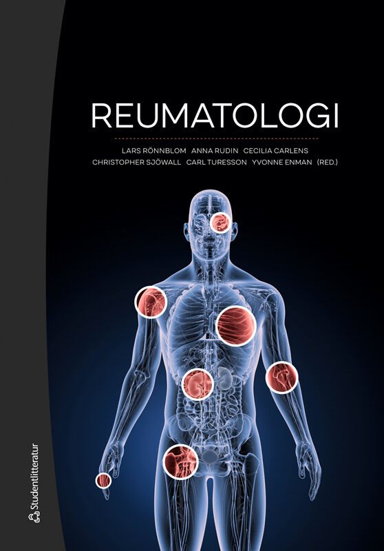 ISBN 9789144167909 Reumatologi